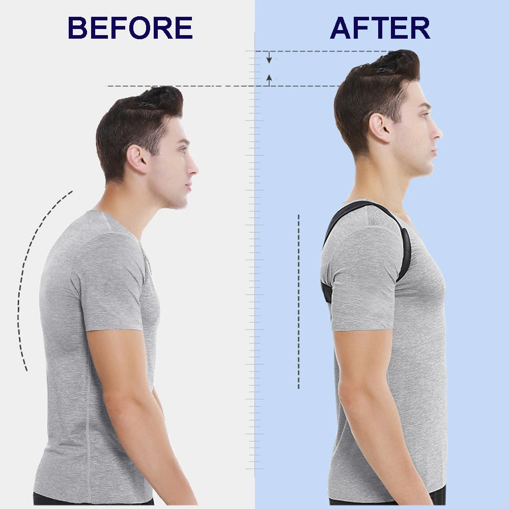 Posture Corrector Clavicle Spine Back Belt Adjustable Unisex Upper Back Shoulder Lumbar Posture Correction SuperFye L for 70-110KG SuperFye