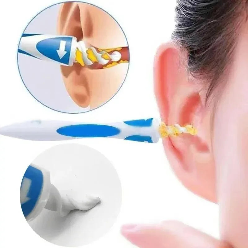 Ear Wax Remover Tool Ear Cleaner With Soft Silicone 16 Replacement Tips Simply To Grab Extract Earwax SuperFye Blue SuperFye